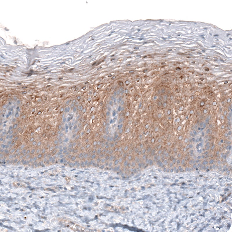 CLIP170 Antibody (CL4844) - Azide and BSA Free Immunohistochemistry-Paraffin: CLIP170 Antibody [NBP3-44108]