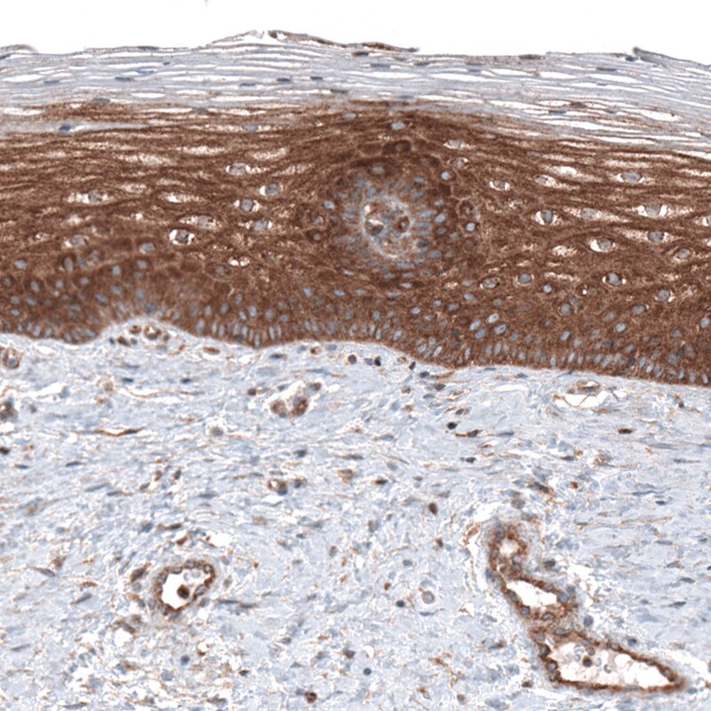 CLIP170 Antibody (CL4851) - Azide and BSA Free Immunohistochemistry-Paraffin: CLIP170 Antibody [NBP3-44109]