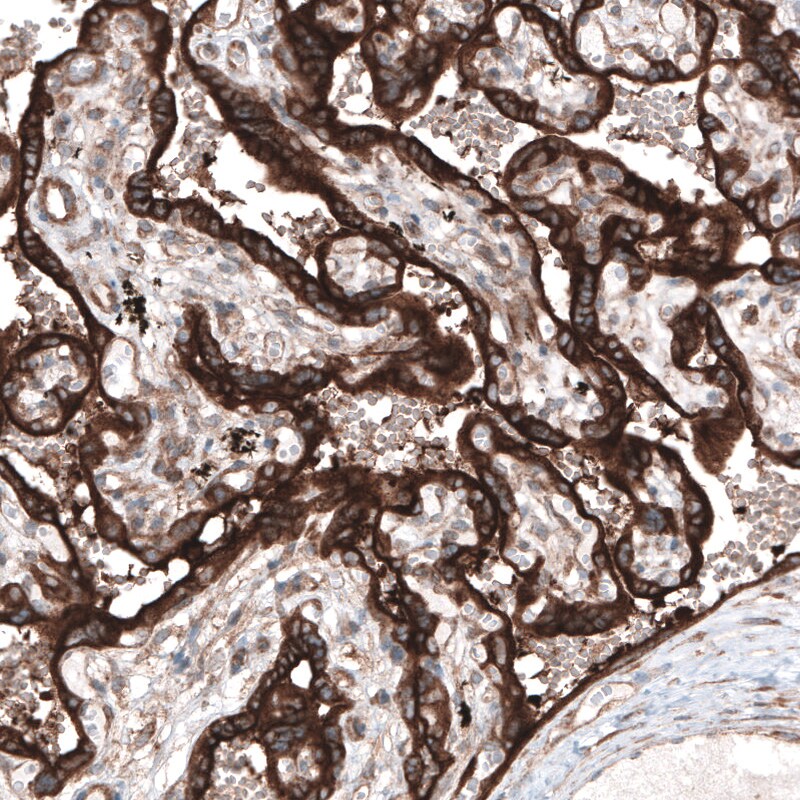 CLIP170 Antibody (CL4851) - Azide and BSA Free Immunohistochemistry-Paraffin: CLIP170 Antibody [NBP3-44109]