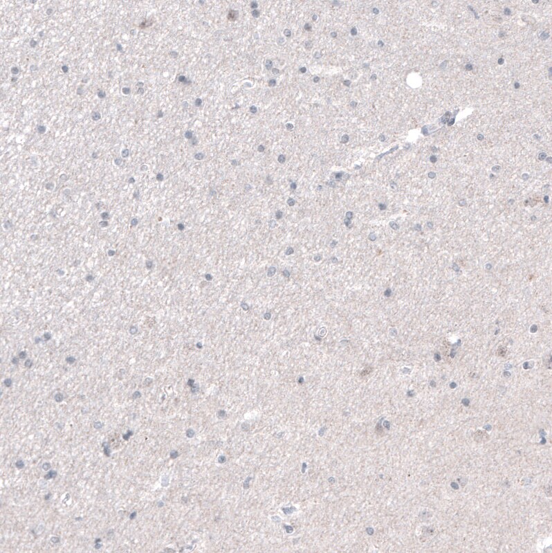 PRAME Antibody (CL5148) - Azide and BSA Free Immunohistochemistry-Paraffin: PRAME Antibody [NBP3-44111]