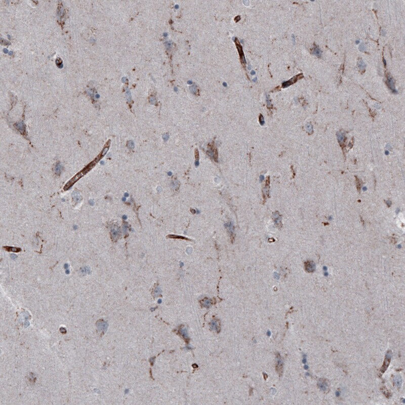 VISTA/B7-H5/PD-1H Antibody (CL3981) - Azide and BSA Free Immunohistochemistry-Paraffin: VISTA/B7-H5/PD-1H Antibody [NBP3-44113]