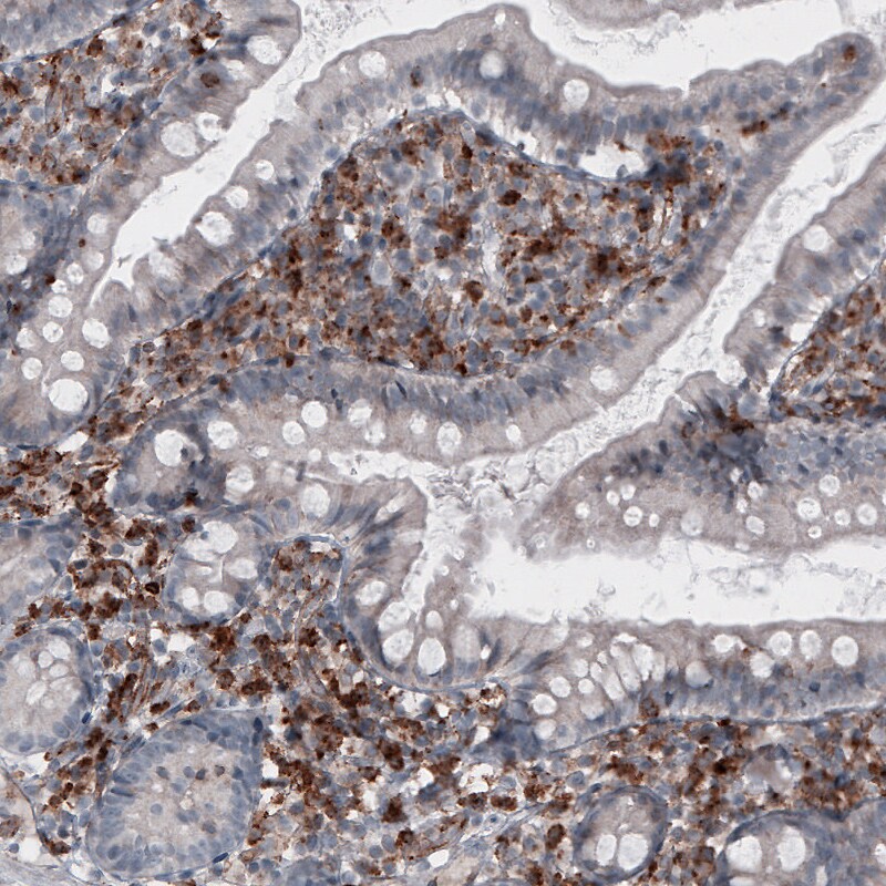 VISTA/B7-H5/PD-1H Antibody (CL3981) - Azide and BSA Free Immunohistochemistry-Paraffin: VISTA/B7-H5/PD-1H Antibody [NBP3-44113]