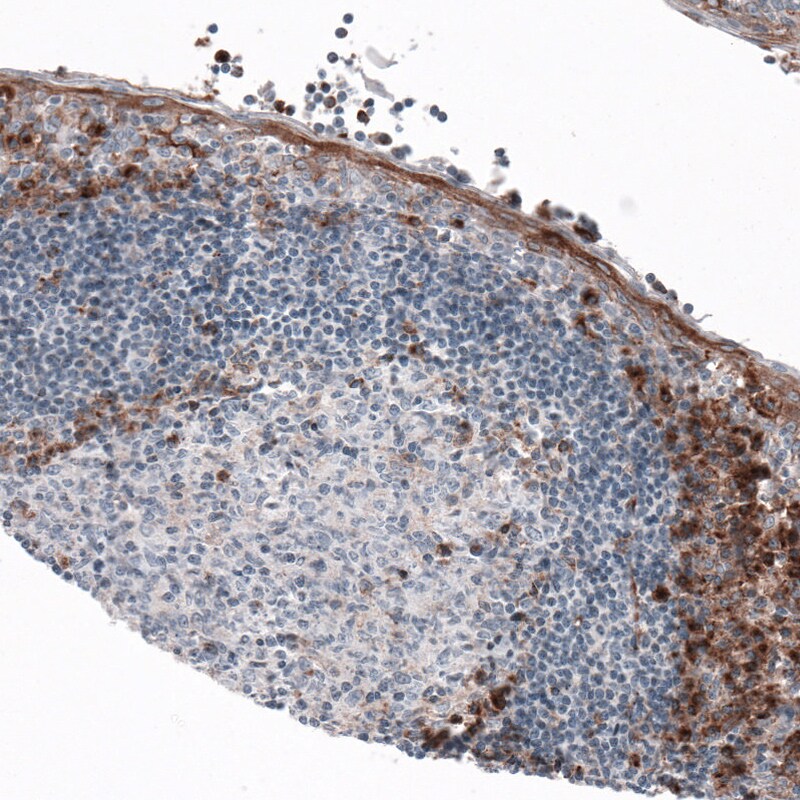 VISTA/B7-H5/PD-1H Antibody (CL3981) - Azide and BSA Free Immunohistochemistry-Paraffin: VISTA/B7-H5/PD-1H Antibody [NBP3-44113]