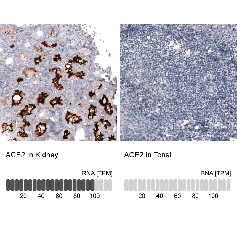 ACE-2 Antibody (CL4013) - Azide and BSA Free Immunohistochemistry-Paraffin: ACE-2 Antibody [NBP3-44114]