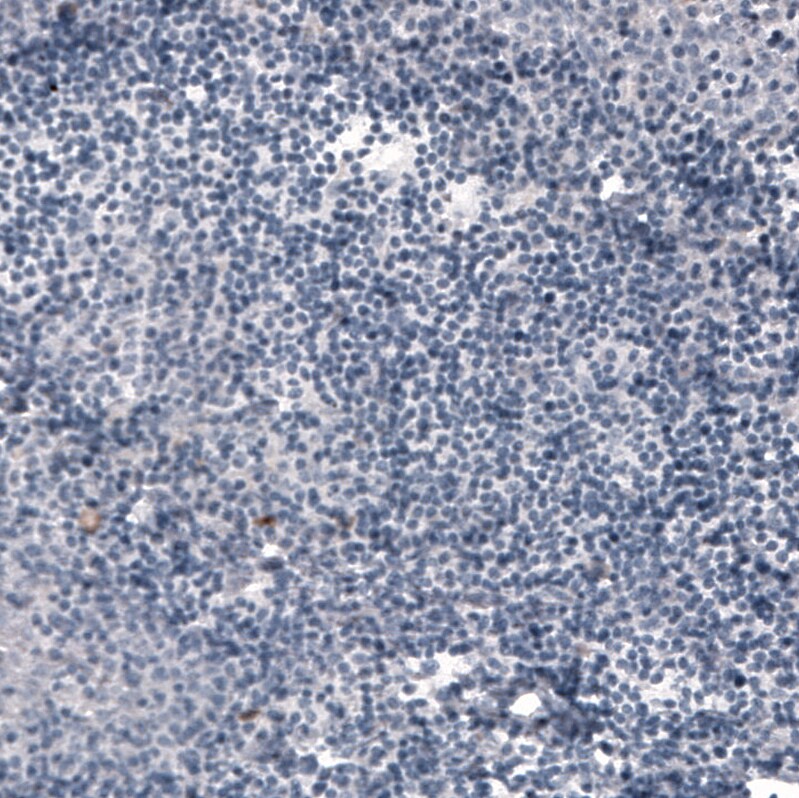 ACE-2 Antibody (CL4013) - Azide and BSA Free Immunohistochemistry-Paraffin: ACE-2 Antibody [NBP3-44114]
