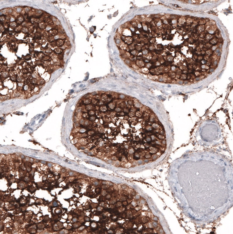 ACE-2 Antibody (CL4013) - Azide and BSA Free Immunohistochemistry-Paraffin: ACE-2 Antibody [NBP3-44114]