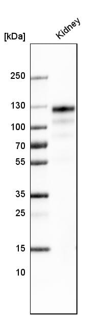 ACE-2 Antibody (CL4013) - Azide and BSA Free Western Blot: ACE-2 Antibody [NBP3-44114]