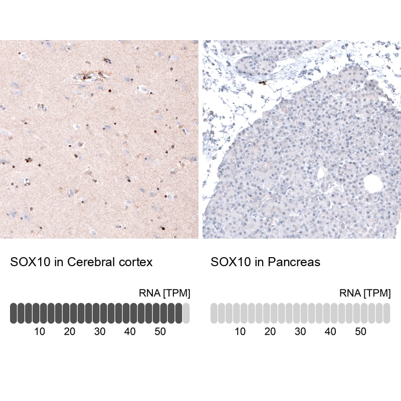 SOX10 Antibody (CL4455) - Azide and BSA Free Immunohistochemistry-Paraffin: SOX10 Antibody [NBP3-44116]