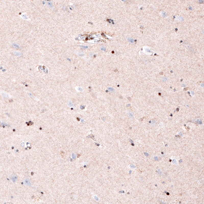 SOX10 Antibody (CL4455) - Azide and BSA Free Immunohistochemistry-Paraffin: SOX10 Antibody [NBP3-44116]