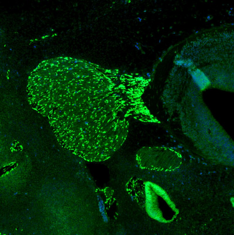SOX10 Antibody (CL4455) - Azide and BSA Free Immunohistochemistry-Paraffin: SOX10 Antibody [NBP3-44116]