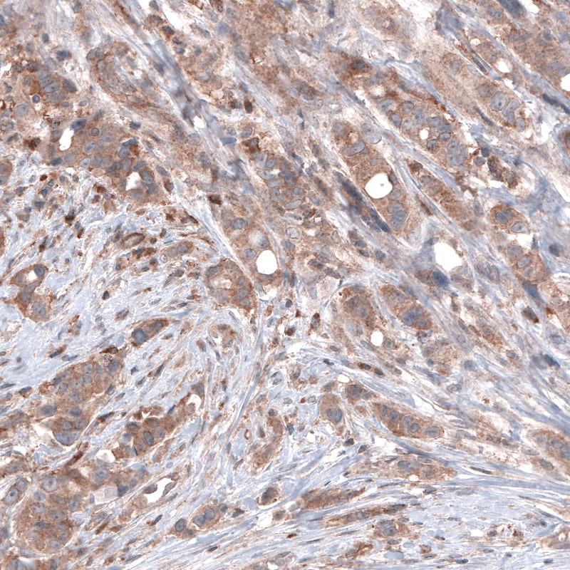 B-Raf Antibody (CL4003) - Azide and BSA Free Immunohistochemistry-Paraffin: B-Raf Antibody [NBP3-44117]