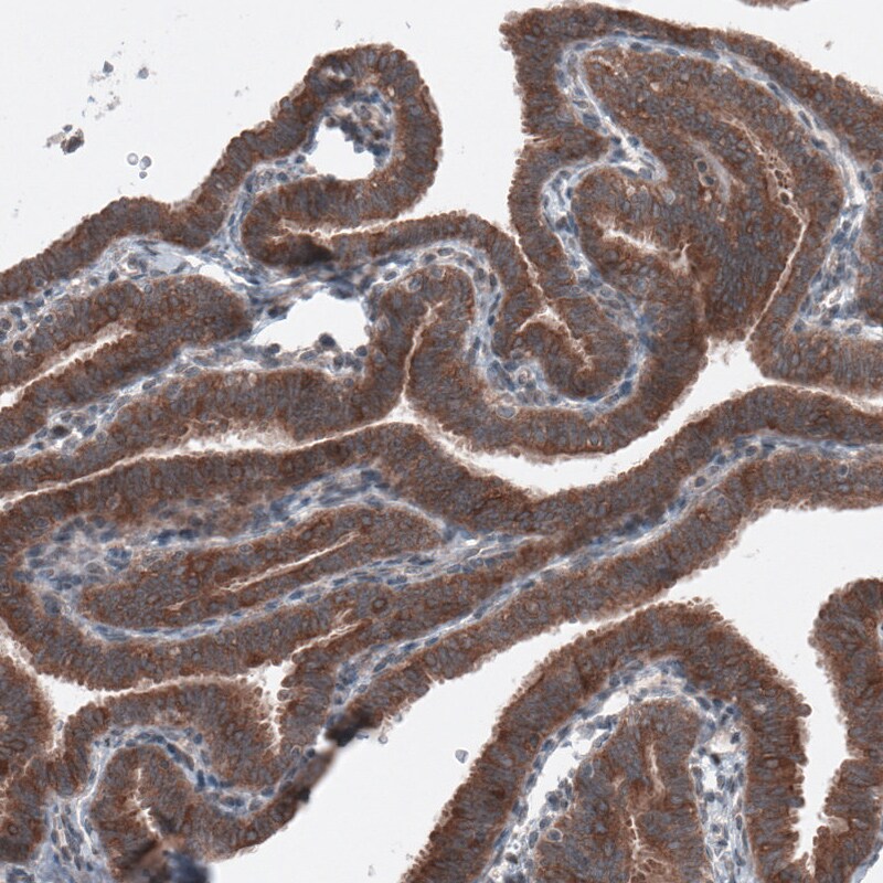 B-Raf Antibody (CL4004) - Azide and BSA Free Immunohistochemistry-Paraffin: B-Raf Antibody [NBP3-44118]