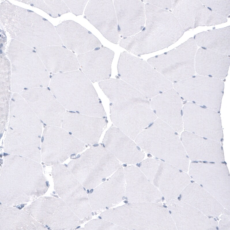 FoxJ1/HFH4 Antibody (CL3989) - Azide and BSA Free Immunohistochemistry-Paraffin: FoxJ1/HFH4 Antibody [NBP3-44120]
