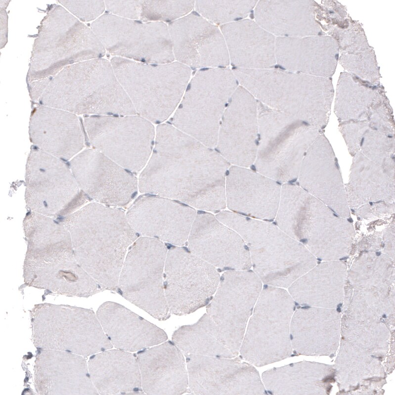 FoxJ1/HFH4 Antibody (CL3991) - Azide and BSA Free Immunohistochemistry-Paraffin: FoxJ1/HFH4 Antibody [NBP3-44121]
