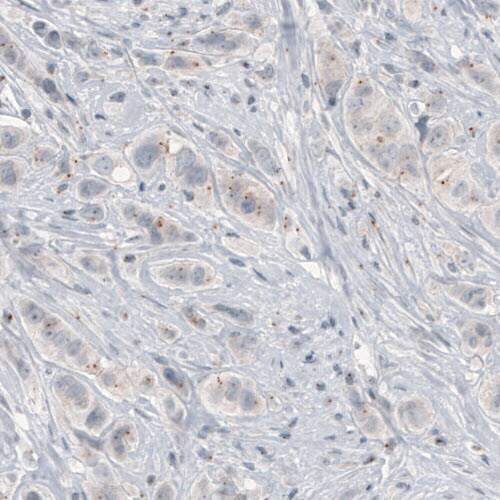 CEP350 Antibody (CL3423) - Azide and BSA Free Immunohistochemistry-Paraffin: CEP350 Antibody [NBP3-44123]