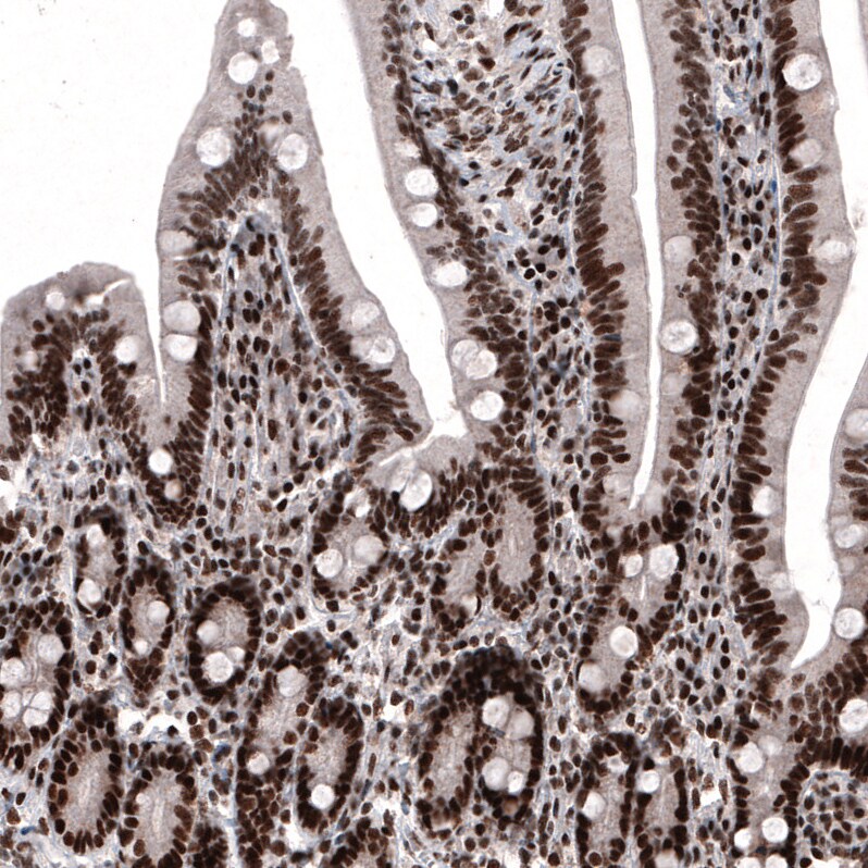 METTL14 Antibody (CL4252) - Azide and BSA Free Immunohistochemistry-Paraffin: METTL14 Antibody [NBP3-44125]