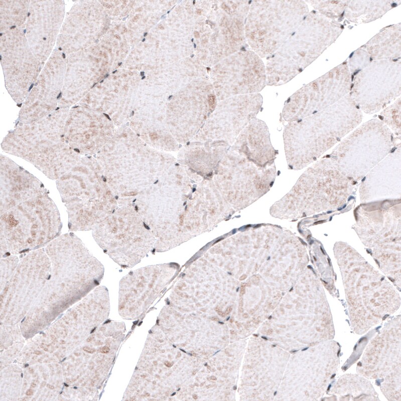 METTL14 Antibody (CL4252) - Azide and BSA Free Immunohistochemistry-Paraffin: METTL14 Antibody [NBP3-44125]