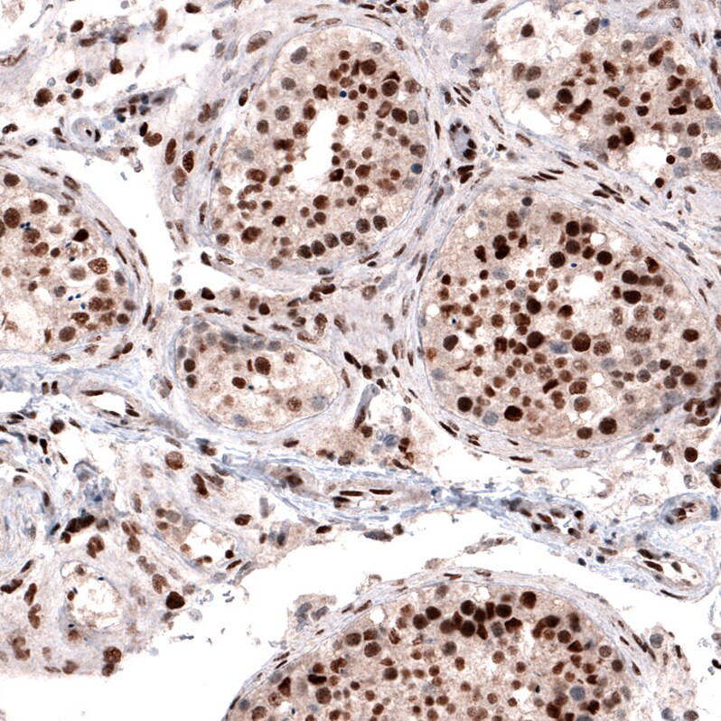 METTL14 Antibody (CL4252) - Azide and BSA Free Immunohistochemistry-Paraffin: METTL14 Antibody [NBP3-44125]