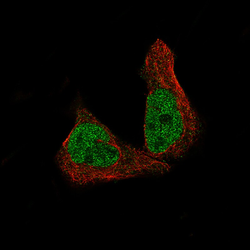 METTL14 Antibody (CL4252) - Azide and BSA Free Immunocytochemistry/ Immunofluorescence: METTL14 Antibody [NBP3-44125]