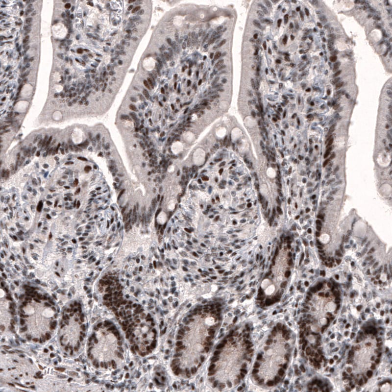 METTL14 Antibody (CL4254) - Azide and BSA Free Immunohistochemistry-Paraffin: METTL14 Antibody [NBP3-44126]