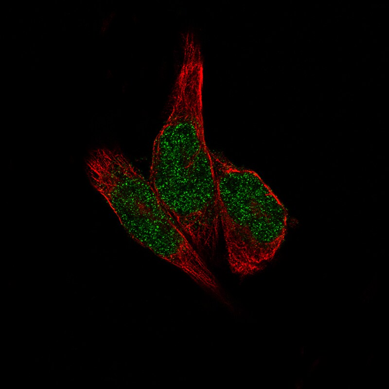 METTL14 Antibody (CL4254) - Azide and BSA Free Immunocytochemistry/ Immunofluorescence: METTL14 Antibody [NBP3-44126]