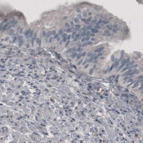 PGM1 Antibody (CL3301) - Azide and BSA Free Immunohistochemistry-Paraffin: PGM1 Antibody [NBP3-44127]