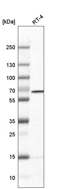 PGM1 Antibody (CL3301) - Azide and BSA Free Western Blot: PGM1 Antibody [NBP3-44127]
