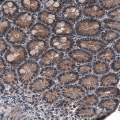 PGM1 Antibody (CL3301) - Azide and BSA Free Immunohistochemistry-Paraffin: PGM1 Antibody [NBP3-44127]