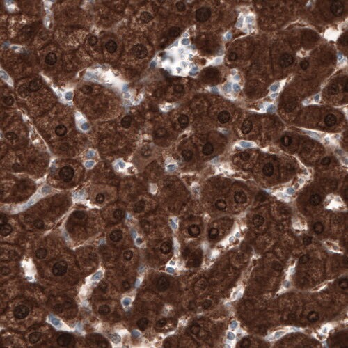 PGM1 Antibody (CL3301) - Azide and BSA Free Immunohistochemistry-Paraffin: PGM1 Antibody [NBP3-44127]