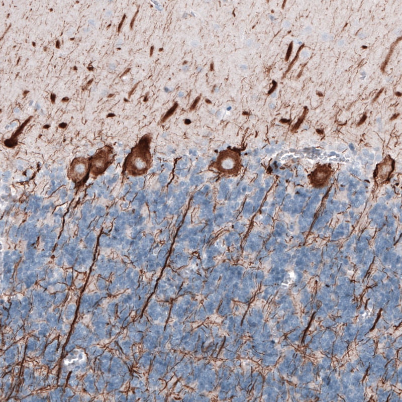 NF-L Antibody (CL4729) - Azide and BSA Free Immunohistochemistry-Paraffin: NF-L Antibody [NBP3-44128]