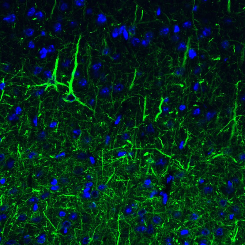 NF-L Antibody (CL4729) - Azide and BSA Free Immunohistochemistry-Paraffin: NF-L Antibody [NBP3-44128]