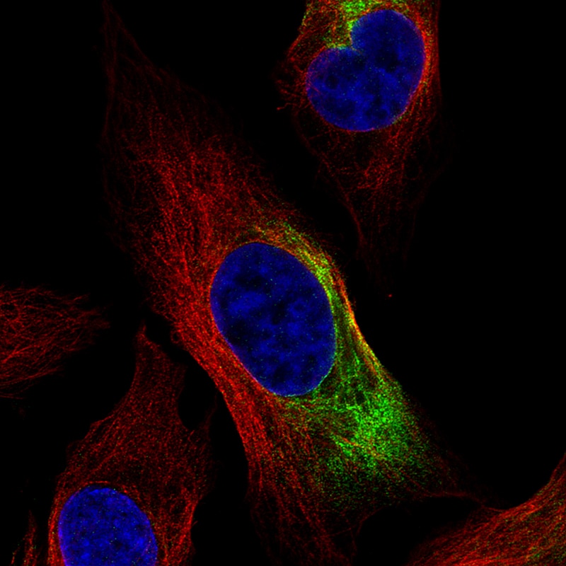 NF-L Antibody (CL4729) - Azide and BSA Free Immunocytochemistry/ Immunofluorescence: NF-L Antibody [NBP3-44128]