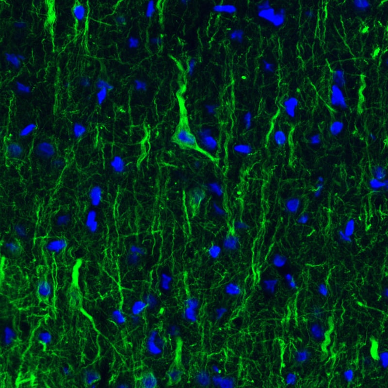 NF-L Antibody (CL4729) - Azide and BSA Free Immunohistochemistry-Paraffin: NF-L Antibody [NBP3-44128]