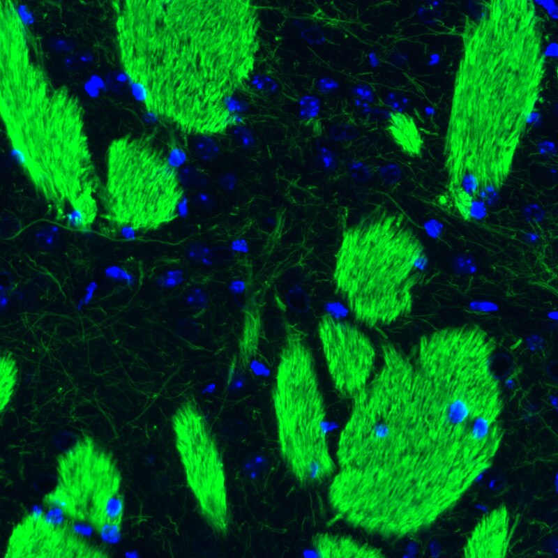 NF-L Antibody (CL4729) - Azide and BSA Free Immunohistochemistry-Paraffin: NF-L Antibody [NBP3-44128]