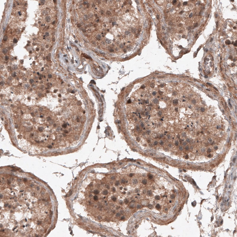 RBCK1 Antibody (CL4289) - Azide and BSA Free Immunohistochemistry-Paraffin: RBCK1 Antibody [NBP3-44129]