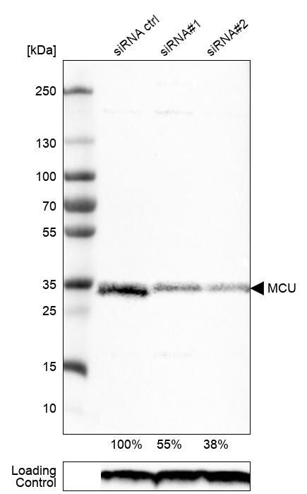 CCDC109A Antibody (CL3576) - Azide and BSA Free Western Blot: CCDC109A Antibody [NBP3-44130]