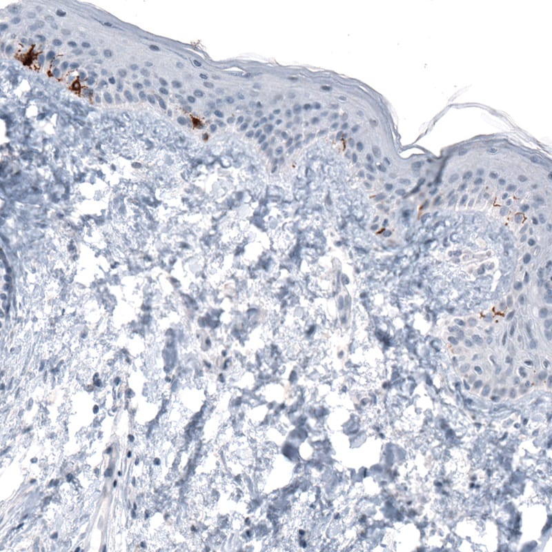 TYRP1 Antibody (CL4906) - Azide and BSA Free Immunohistochemistry-Paraffin: TYRP1 Antibody [NBP3-44131]