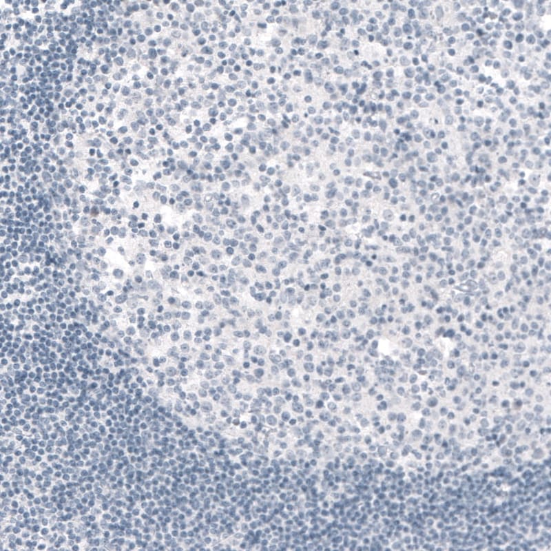 TYRP1 Antibody (CL4906) - Azide and BSA Free Immunohistochemistry-Paraffin: TYRP1 Antibody [NBP3-44131]