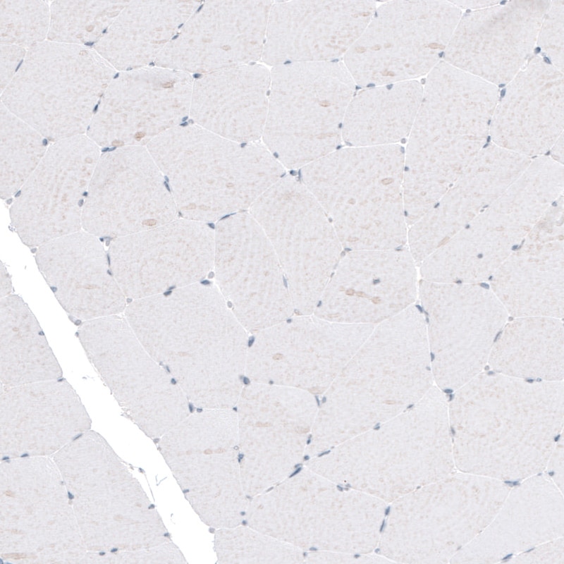 TYRP1 Antibody (CL4917) - Azide and BSA Free Immunohistochemistry-Paraffin: TYRP1 Antibody [NBP3-44132]