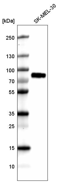 TYRP1 Antibody (CL4917) - Azide and BSA Free Western Blot: TYRP1 Antibody [NBP3-44132]