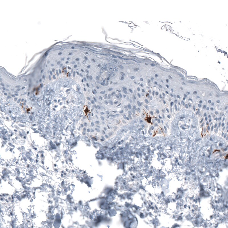 TYRP1 Antibody (CL4917) - Azide and BSA Free Immunohistochemistry-Paraffin: TYRP1 Antibody [NBP3-44132]
