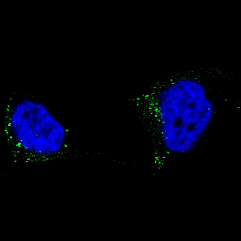 TYRP1 Antibody (CL4917) - Azide and BSA Free Immunocytochemistry/ Immunofluorescence: TYRP1 Antibody [NBP3-44132]