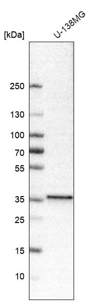 NKX2.2 Antibody (CL11380) - Azide and BSA Free Western Blot: NKX2.2 Antibody [NBP3-44133]