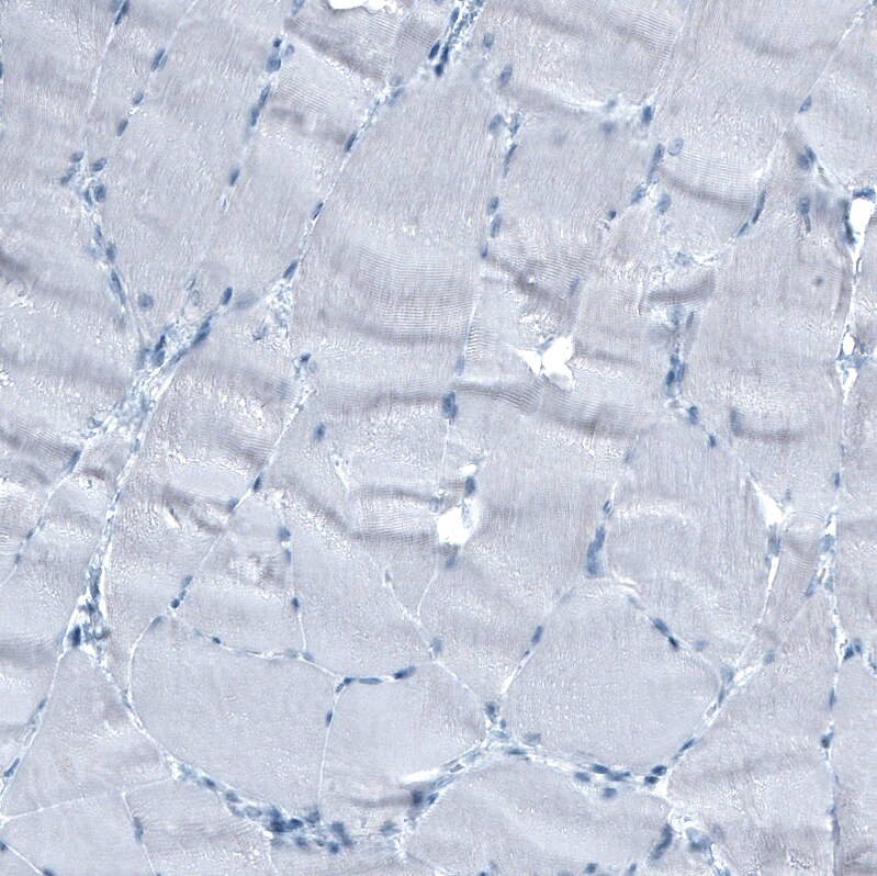 alpha-Fetoprotein/AFP Antibody (CL9766) - Azide and BSA Free Immunohistochemistry-Paraffin: alpha-Fetoprotein/AFP Antibody [NBP3-44135]