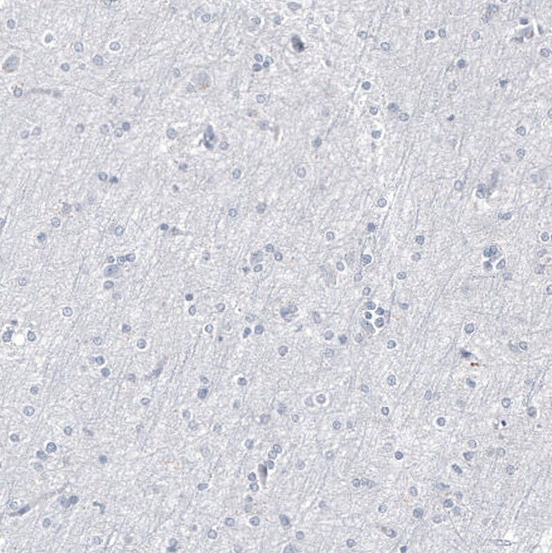 Progesterone R B/NR3C3 Antibody (CL8721) - Azide and BSA Free Immunohistochemistry-Paraffin: Progesterone R B/NR3C3 Antibody [NBP3-44136]