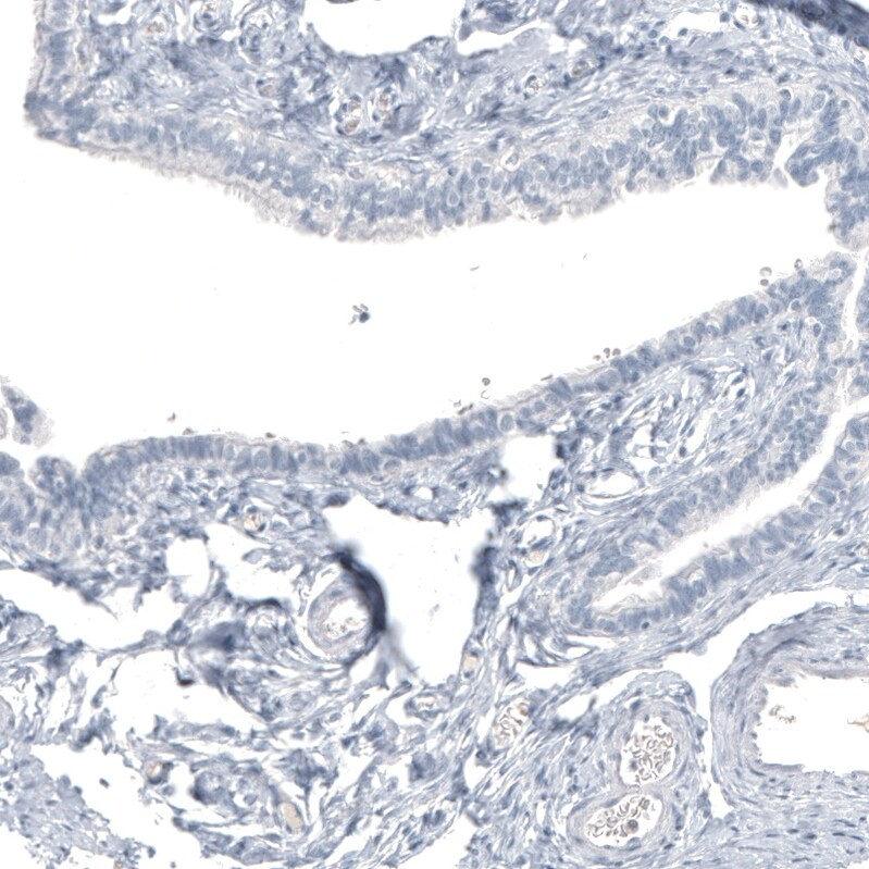 HO-1/HMOX1/HSP32 Antibody (CL11661) - Azide and BSA Free Immunohistochemistry-Paraffin: HO-1/HMOX1/HSP32 Antibody [NBP3-44138]