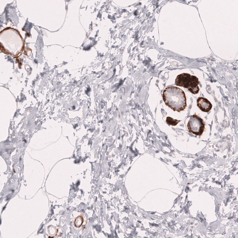 Myosin heavy chain 11 Antibody (CL14617) - Azide and BSA Free Immunohistochemistry-Paraffin: Myosin heavy chain 11 Antibody [NBP3-44140]