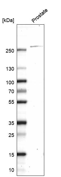 Myosin heavy chain 11 Antibody (CL14617) - Azide and BSA Free Western Blot: Myosin heavy chain 11 Antibody [NBP3-44140]