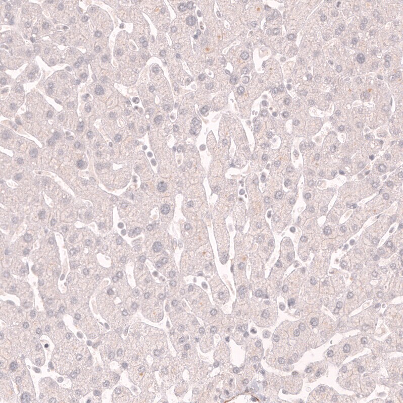 Myosin heavy chain 11 Antibody (CL14617) - Azide and BSA Free Immunohistochemistry-Paraffin: Myosin heavy chain 11 Antibody [NBP3-44140]