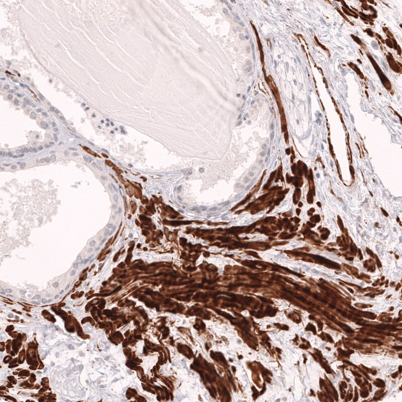 Myosin heavy chain 11 Antibody (CL14617) - Azide and BSA Free Immunohistochemistry-Paraffin: Myosin heavy chain 11 Antibody [NBP3-44140]